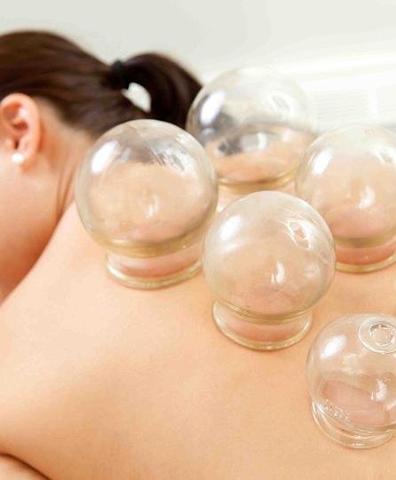 cupping.jpg Bel bankası - Image 1